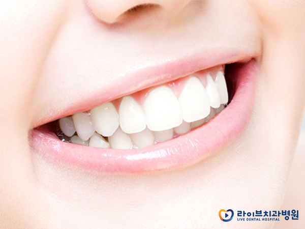 앞니교정, 앞니를 빠르게 개선하는 방법 관련 이미지 5
