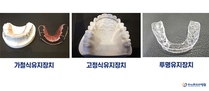 치아교정, 방법과 과정은? 관련 이미지 10