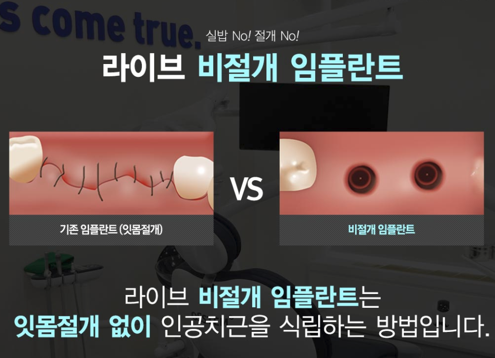 부평치과 임플란트 어디로가야할까? 관련 이미지 4