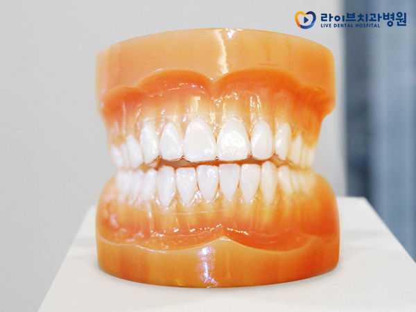 치아교정비용, 정확한 플랜으로 올바른 치료를! 관련 이미지 6