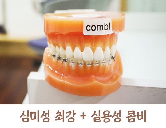 교정기의 종류에 대해 알아보자! 관련 이미지 7