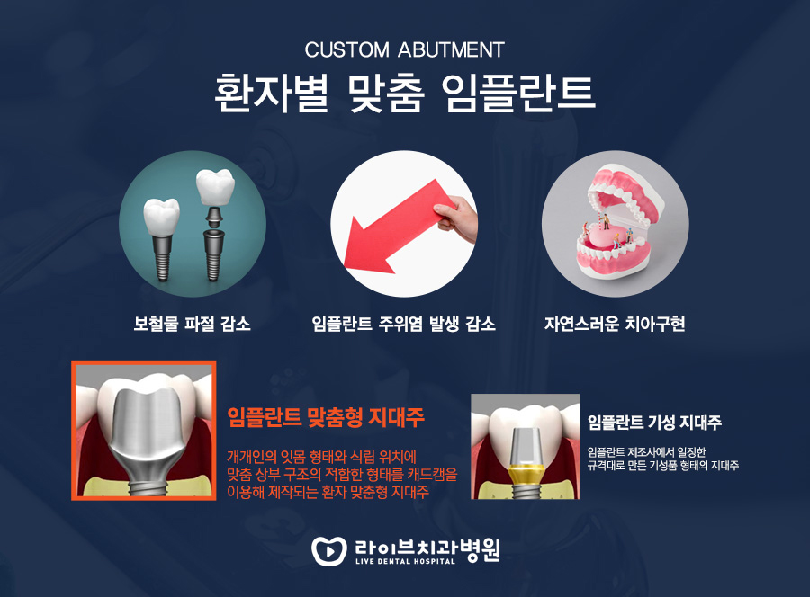임플란트보험 아는만큼 보인다! 관련 이미지 4
