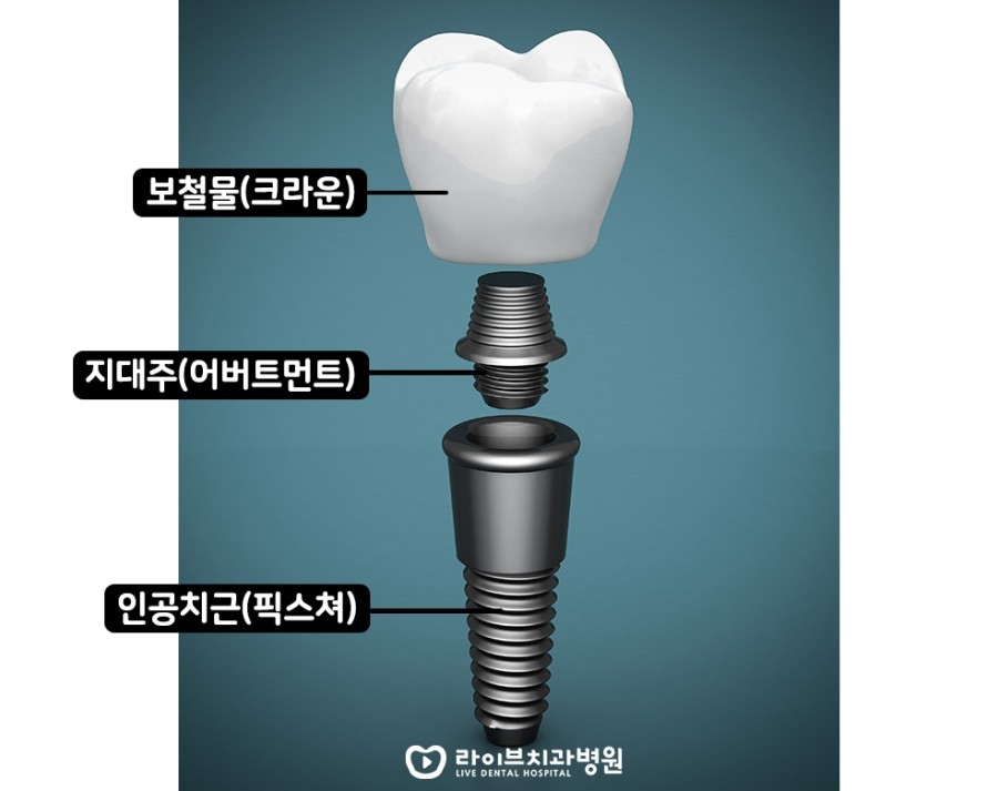 [4월세미나] 강남점, 인천점 보철과의 스텝세미나 관련 이미지 3
