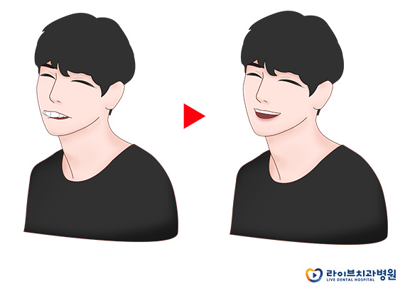 치아교정전후, 얼마나 달라질 수 있을까? 관련 이미지 2