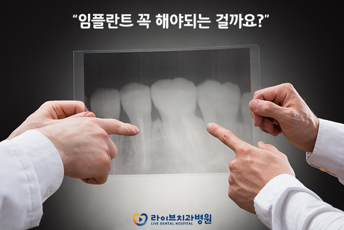 임플란트가격 잘 따져보고 선택하자 관련 이미지 4