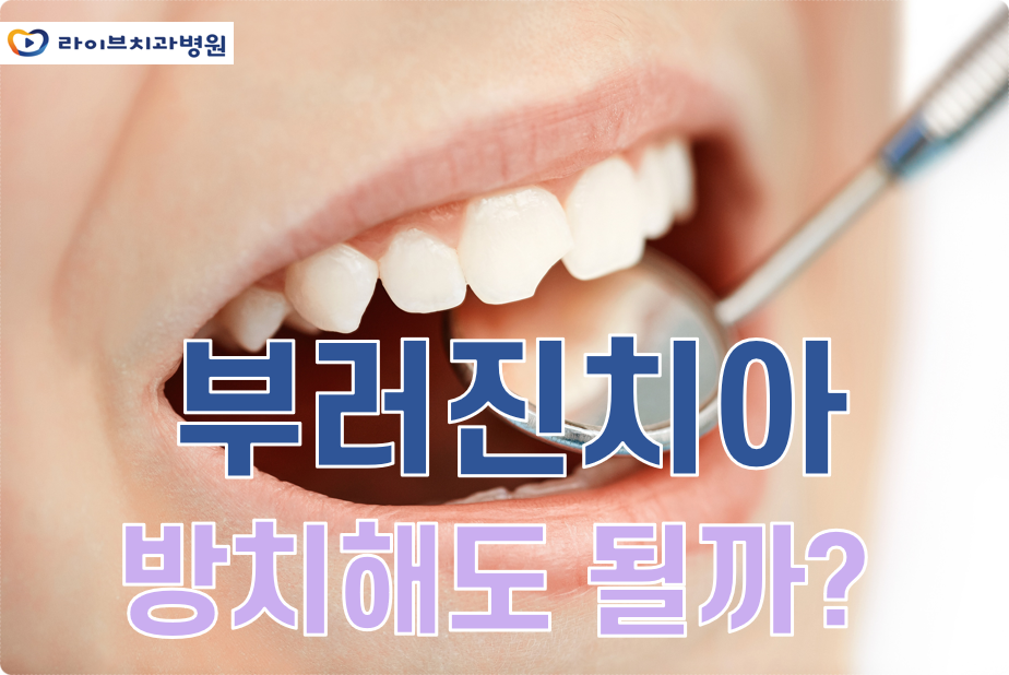 부러진치아 방치해도 될까? 관련 이미지 1