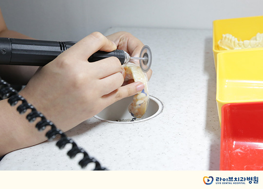 투명교정, 안보인다고 얕보지 마세요! 관련 이미지 5