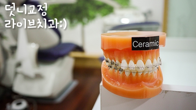 라이브치과병원에서 덧니교정하고 이미지변신 관련 이미지 2