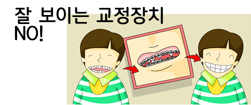 컴플렉스를 없애는 설측교정! 관련 이미지 4