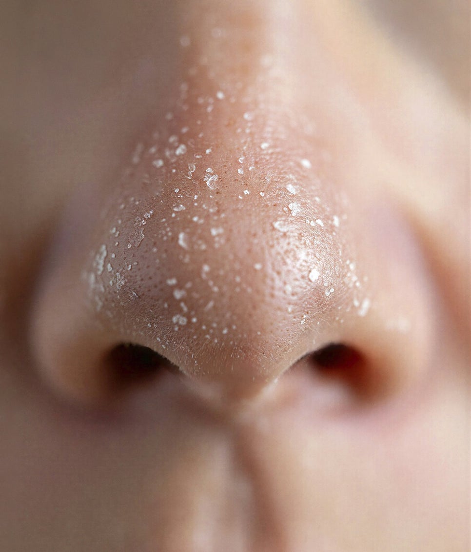 What Are the Symptoms When the Skin Barrier Breaks Down? image 3