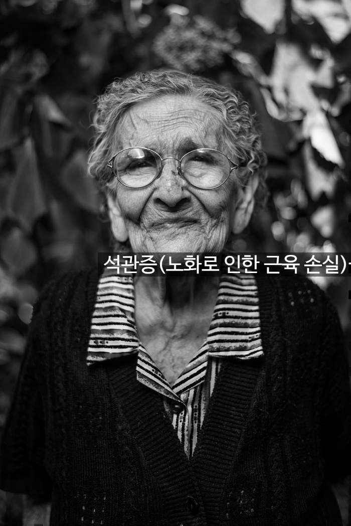 석관증(노화로 인한 근육 손실)을 퇴치하는 방법입니다. 관련 이미지 1