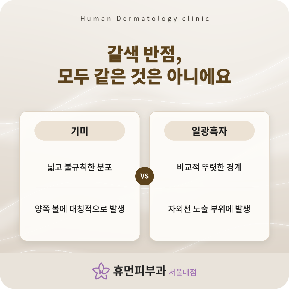 방배피부과 기미, 유독 양쪽 볼에 색소가 오래 남는 이유 관련 이미지 3