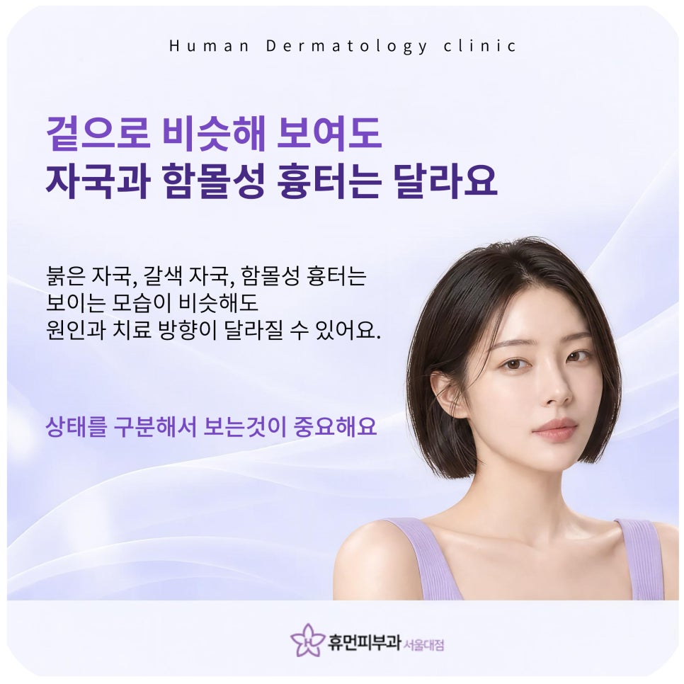 상도피부과 여드름흉터, 깊이만 보고 치료하지 않아요 관련 이미지 3