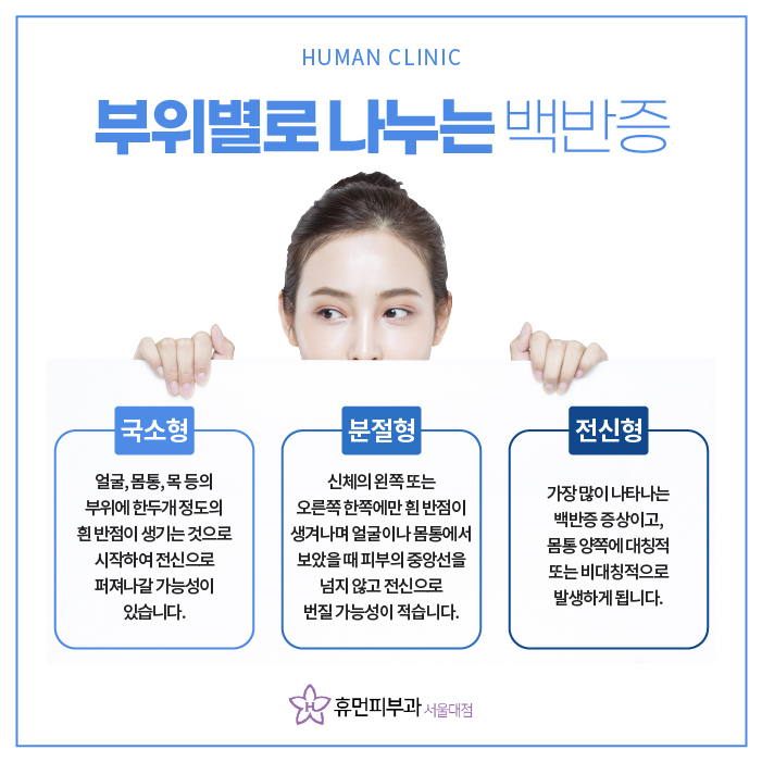 서울대입구역피부과 백반증 고민된다면? 관련 이미지 4