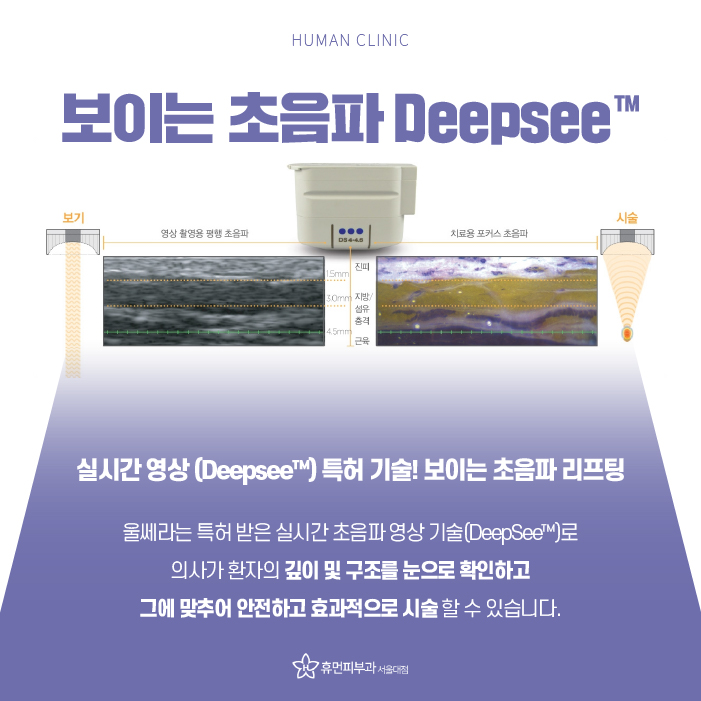 상도동피부과 처진 얼굴살 개선 방법은 무엇일까? 관련 이미지 8