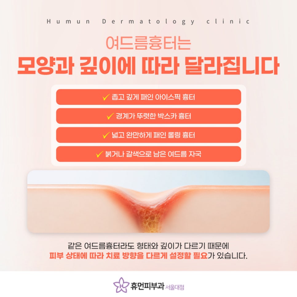 상도피부과 흉터와 모공 함께 진단해야 하는 이유 관련 이미지 4