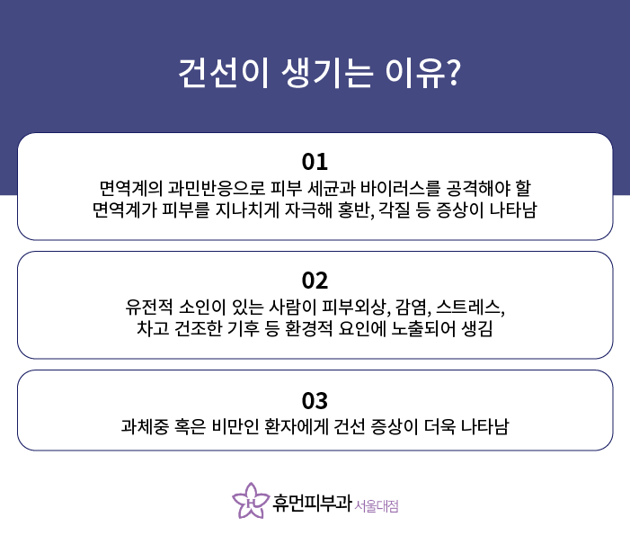 난곡동피부과 백반증과 건선 방치하지마세요 관련 이미지 6