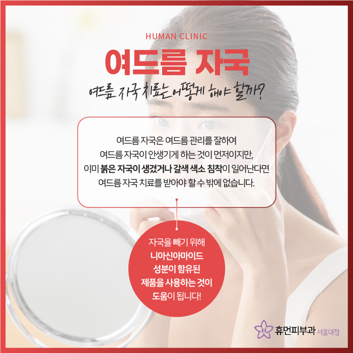 흑석동피부과 여드름 자국으로 말미암은 스트레스, 어떻게 개선해야 할까 관련 이미지 3