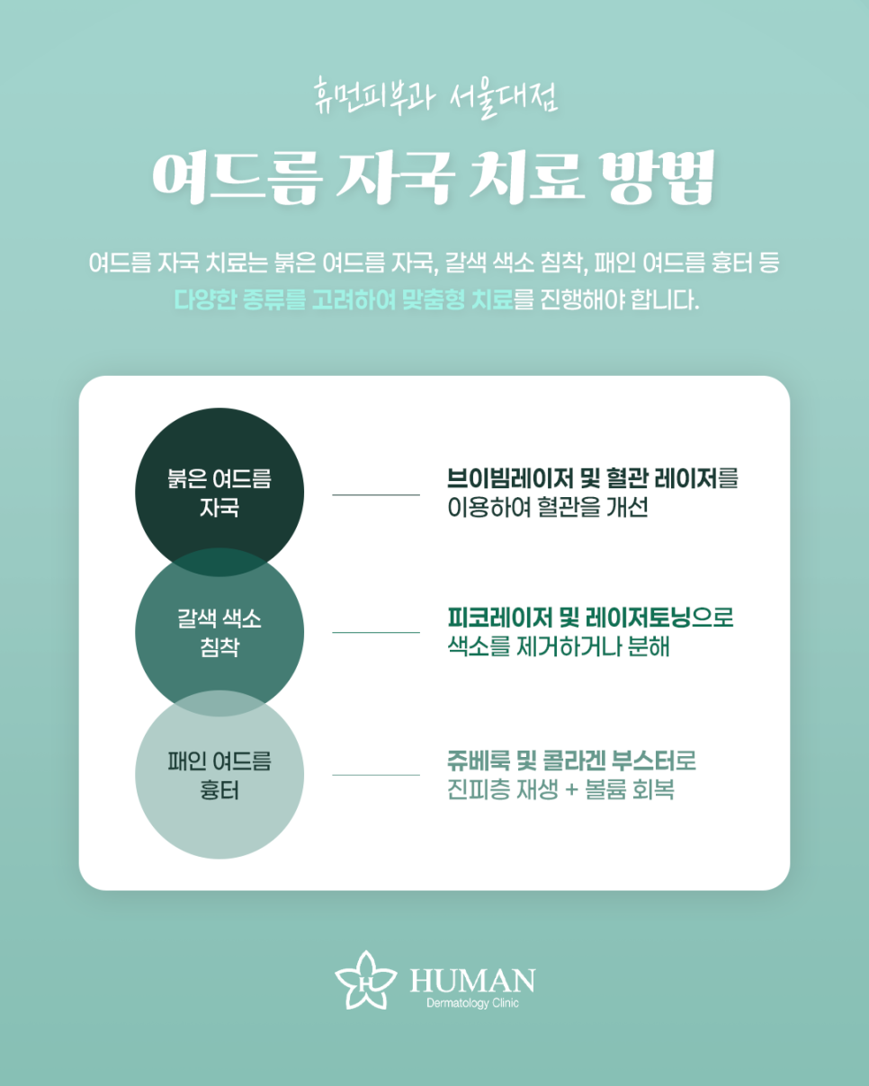 서울대입구 여드름자국치료 자국이 남기 전에 알아야 할 것들 관련 이미지 2