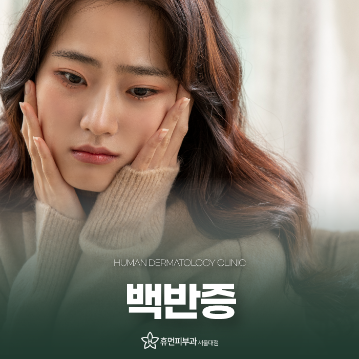 이수역피부과 백반증치료백반증원인을 알아보고 치료할 수 있는 방법은 관련 이미지 1