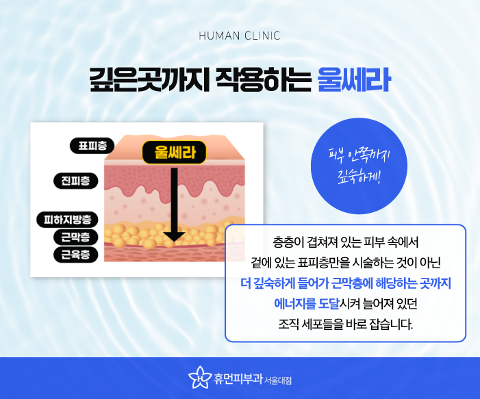 서울대입구역피부과 서울울쎄라로 동안 피부 만들기 관련 이미지 5