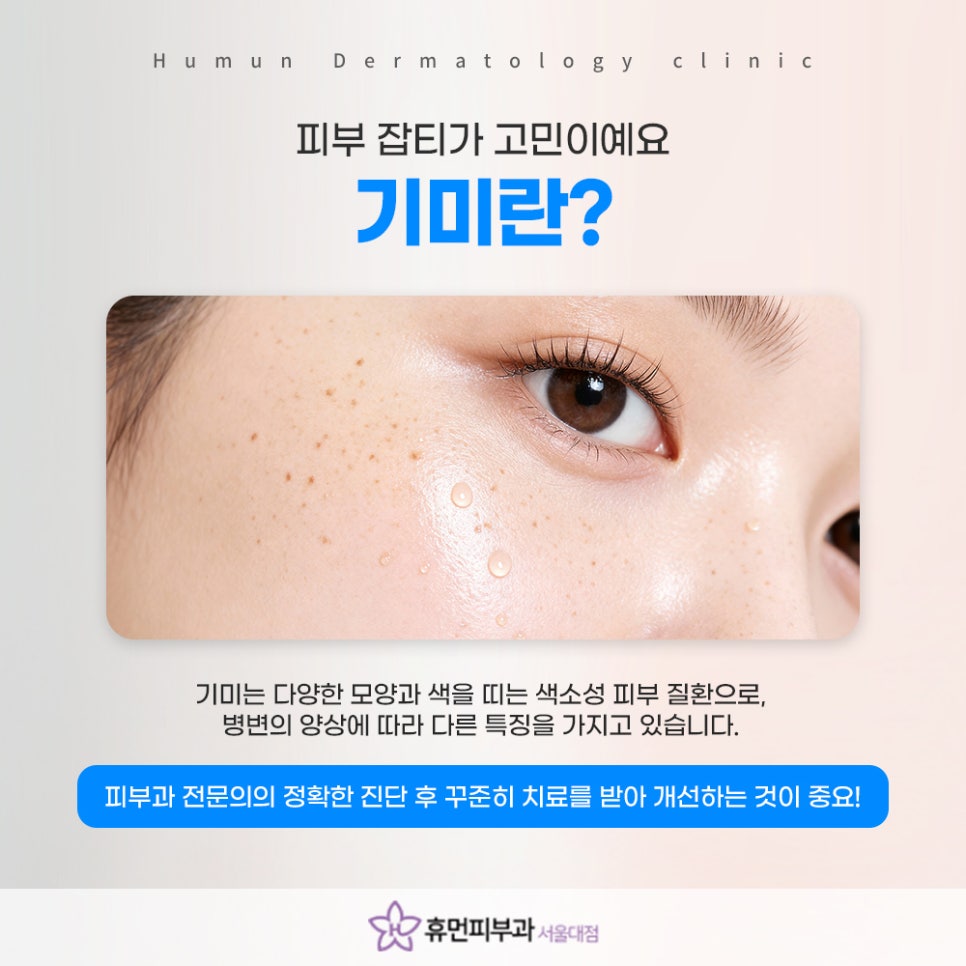 Customized Diagnosis You Must Check at a Sillim Melasma Dermatology Clinic image 3