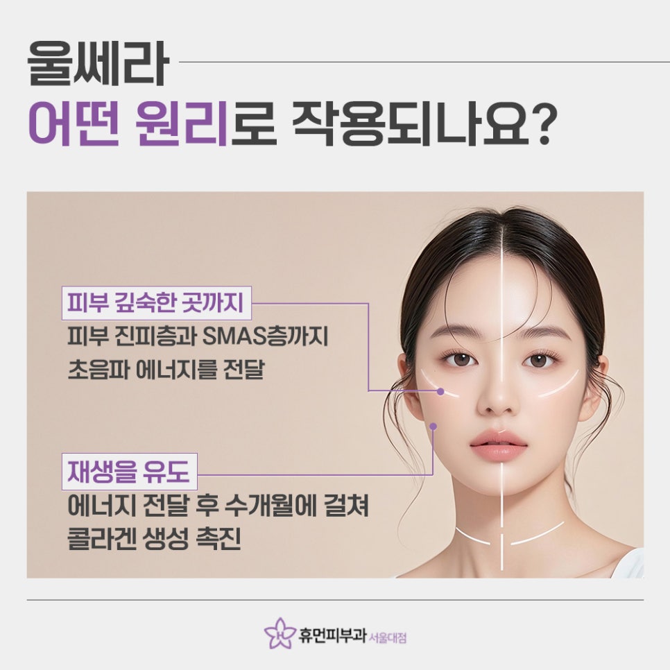 봉천동울쎄라 탄력 있는 피부 되찾을 수 있는 관련 이미지 4