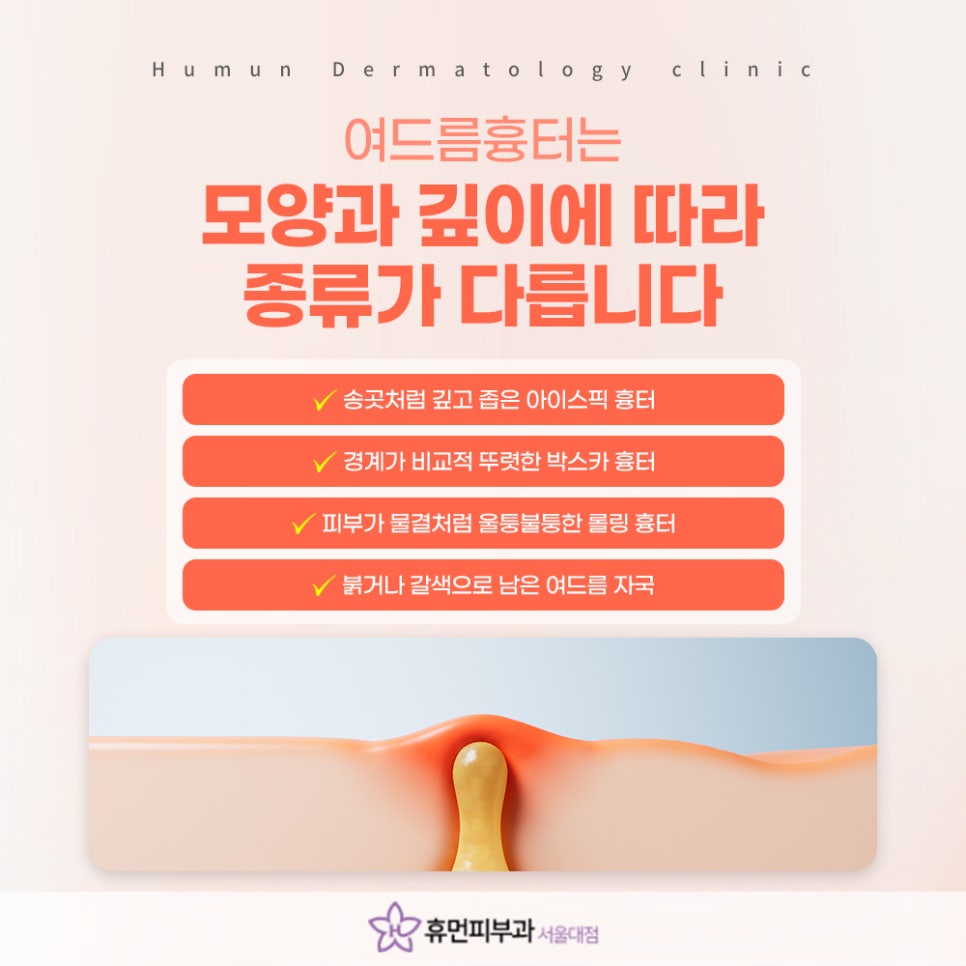 서울대입구역 여드름흉터치료, 흉터 유형에 맞춘 치료가 중요 관련 이미지 3