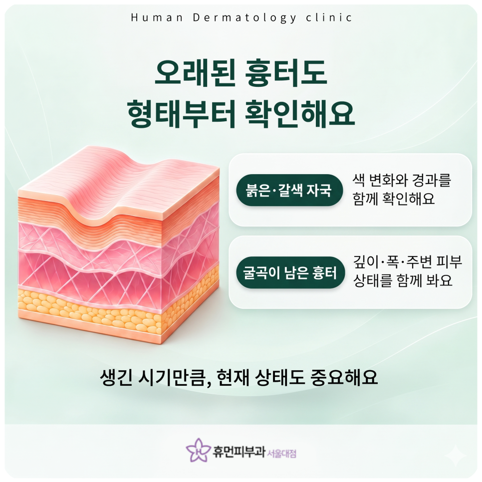 서울대입구피부과 여드름흉터, 자국일까 흉터일까 먼저 구분해요 관련 이미지 6