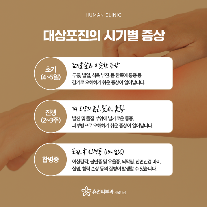 구로디지털단지피부과 대상포진병원 대상포진초기증상 바로 알고 빠른 시기 내에 회복을 관련 이미지 4
