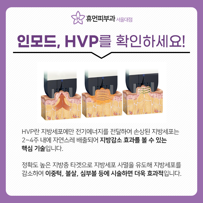서울인모드 FX효과는 무엇일까요? 관련 이미지 6