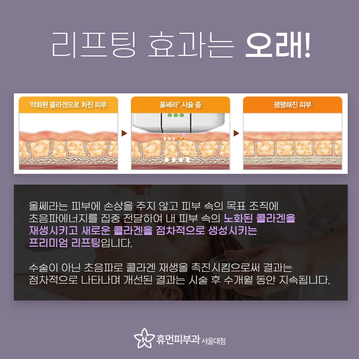 울쎄라병원 피부과전문의에게 받아야하는 이유! 관련 이미지 5