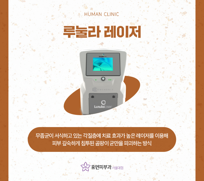 무좀치료법 제대로 알아보고 싶다면? 관련 이미지 6