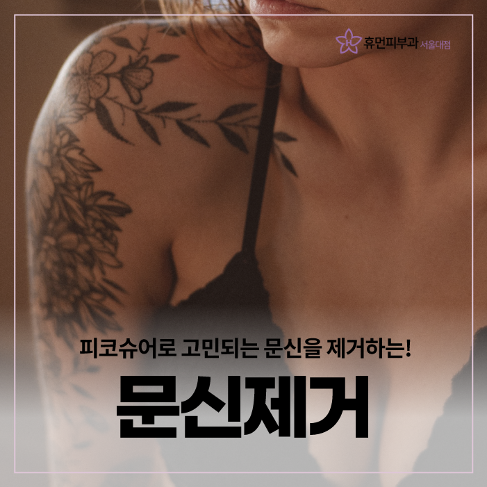 문신지우는법 잉크와 멜라닌만 선택적으로 제거 관련 이미지 1