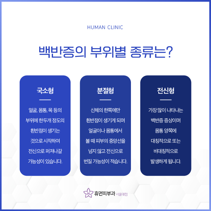 서울대입구역피부과 백반증 치료하고 싶다면? 관련 이미지 5