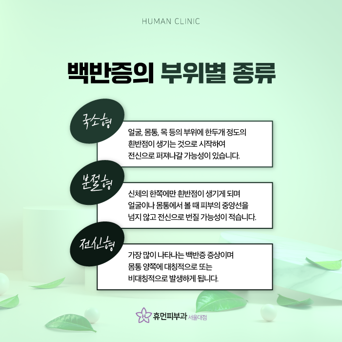 이수역피부과 백반증치료백반증원인을 알아보고 치료할 수 있는 방법은 관련 이미지 4