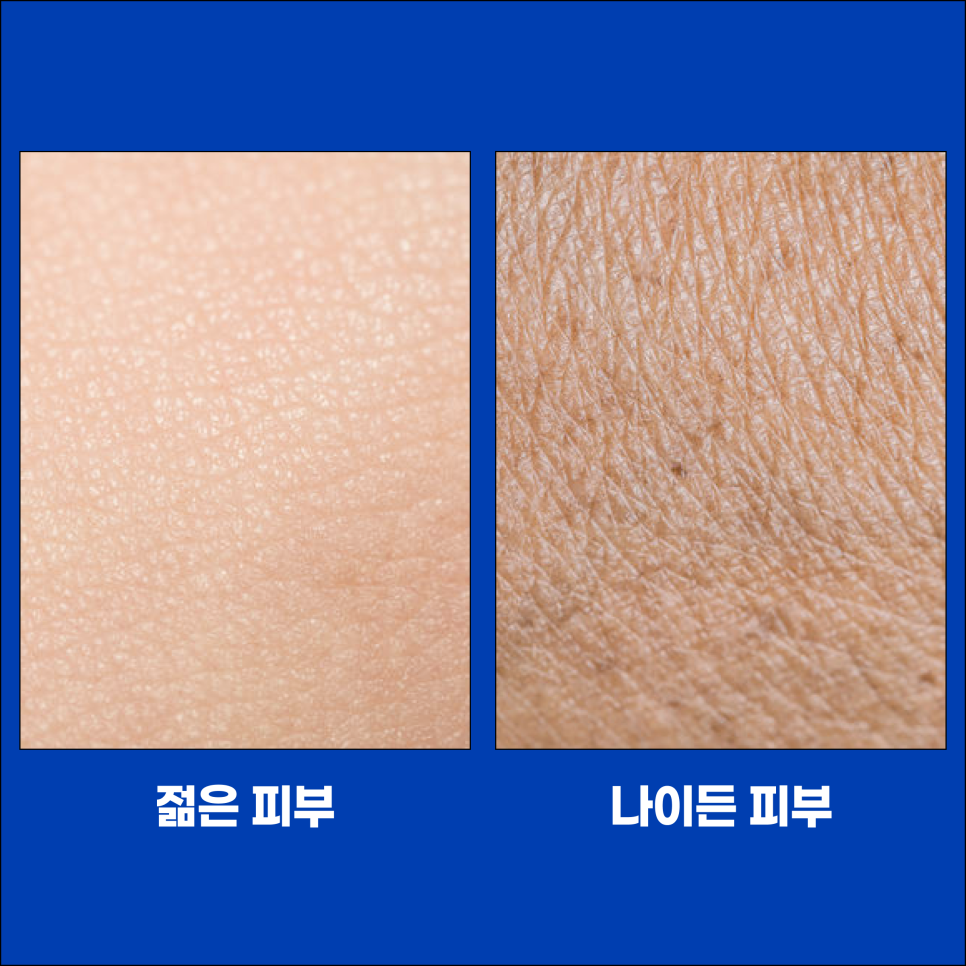 What Lifting Treatment Should I Get at Seoul National University Station to Avoid Regret? image 3
