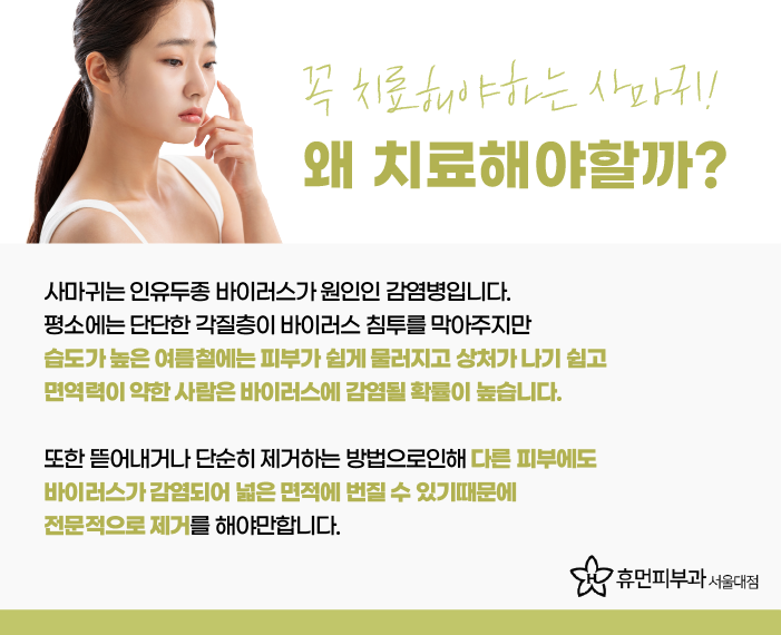 서울대역피부과 사마귀치료 더 심해지기 전에 관련 이미지 3