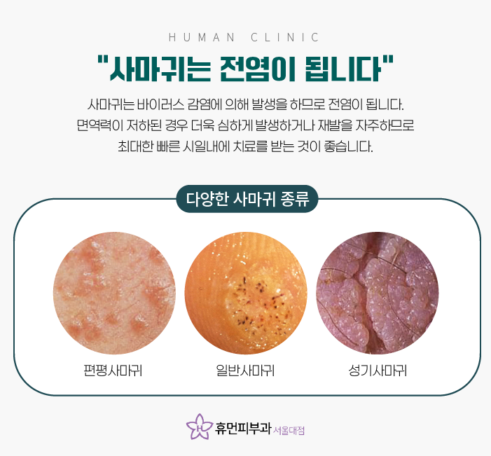 방배동피부과 가다실 9가로 사마귀까지 관련 이미지 6