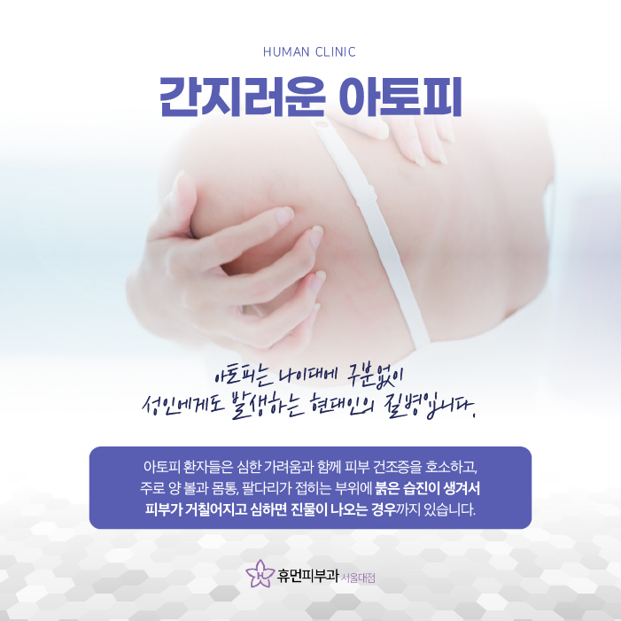 아토피피부과 봄철에 더욱 유의해야 하는 이유? 관련 이미지 2