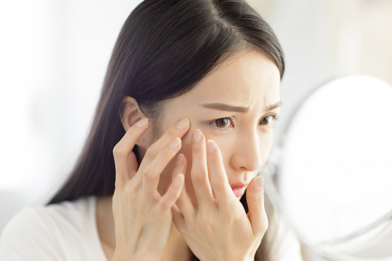 Why Does Acne Keep Coming Back? When Dermatological Treatment Is Needed image 1