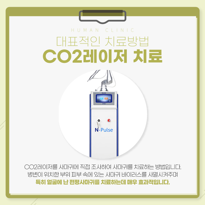 서울대역피부과 사마귀치료 더 심해지기 전에 관련 이미지 6