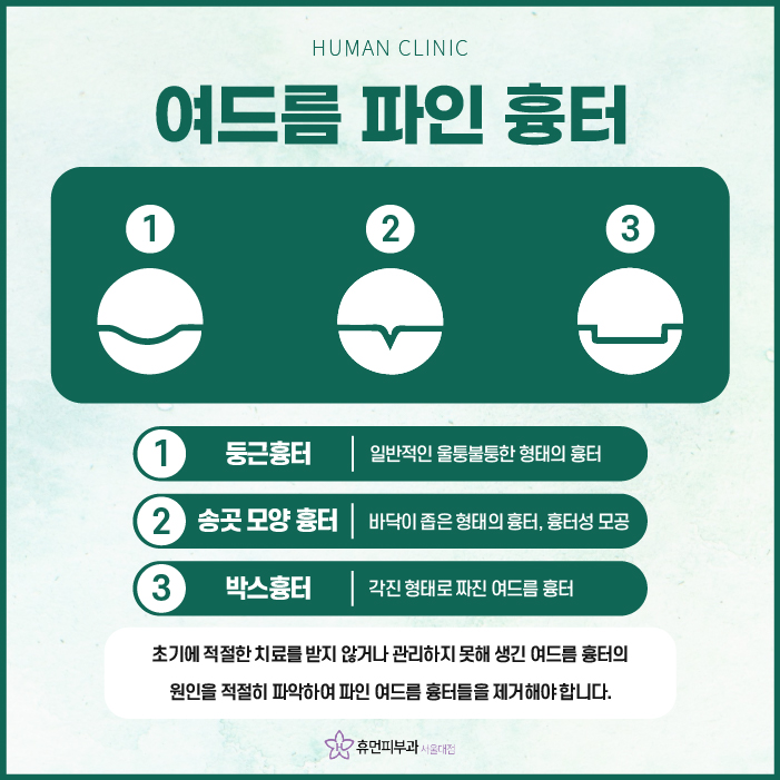 중앙대피부과 여드름파인흉터 확실하게 치료하려면? 관련 이미지 2