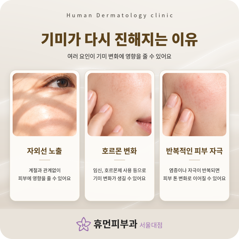 방배피부과 기미, 유독 양쪽 볼에 색소가 오래 남는 이유 관련 이미지 4