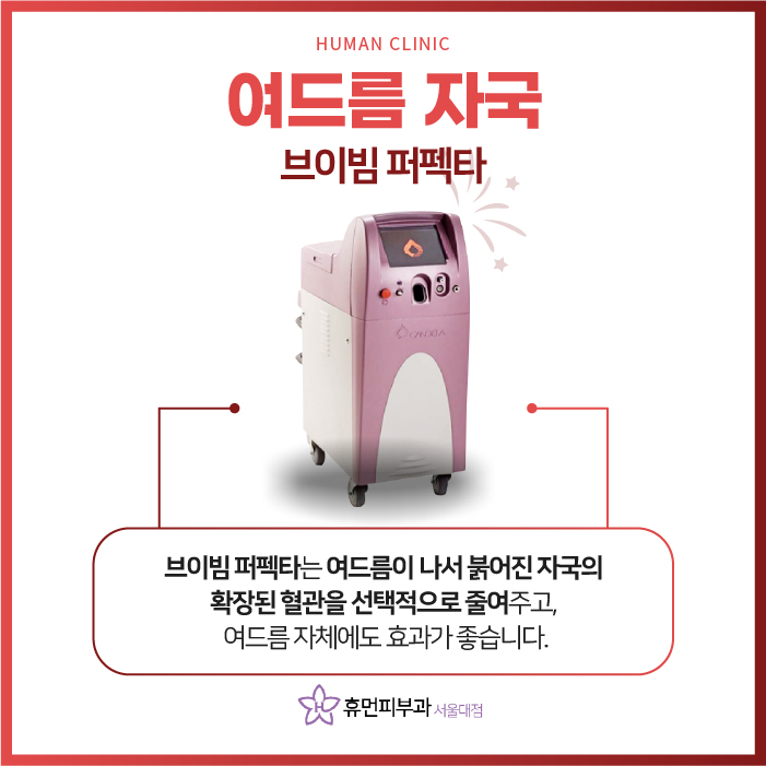 흑석동피부과 여드름 자국으로 말미암은 스트레스, 어떻게 개선해야 할까 관련 이미지 4