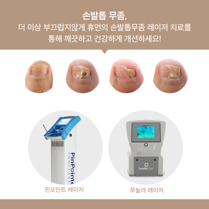 관악구피부과 손발톱 무좀치료 부담없이 관련 이미지 2