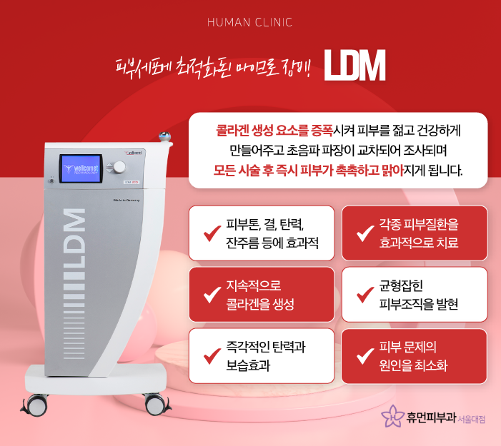 여드름자국레이저 여드름 제네시스 브이빔 LDM으로 여드름관리 해보자 관련 이미지 6