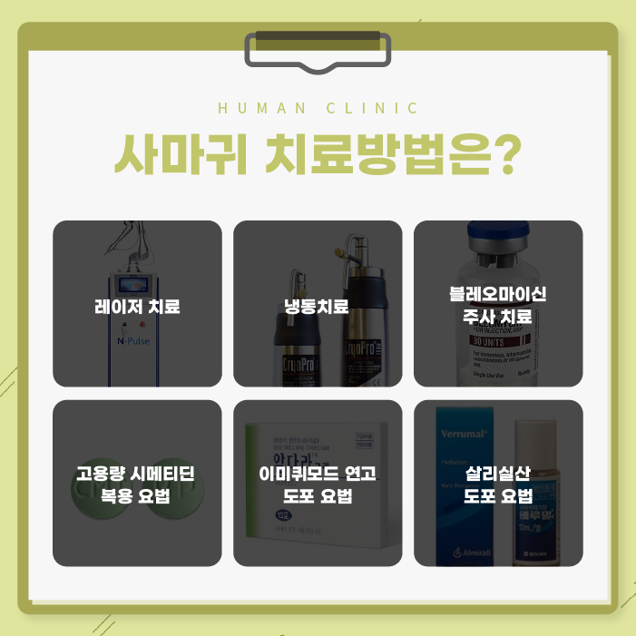 서울대역피부과 사마귀치료 더 심해지기 전에 관련 이미지 5