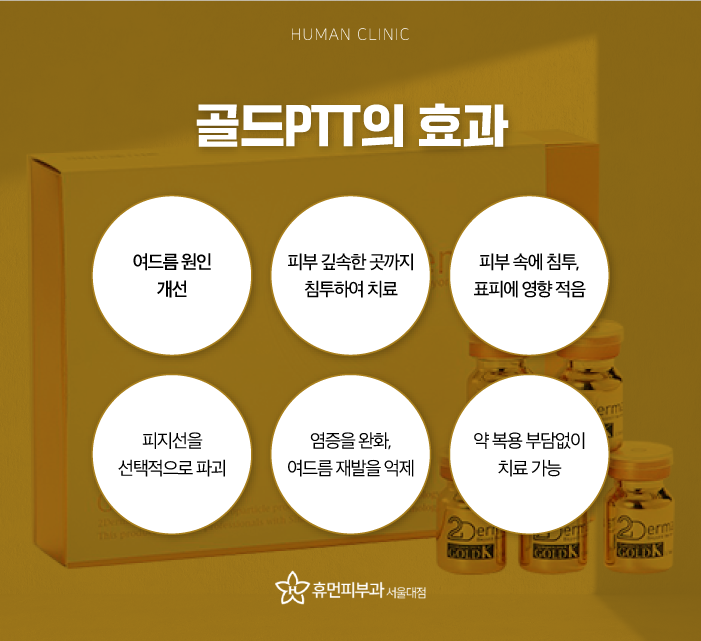 서울대입구역피부과 피부과여드름치료 여드름피부관리 해도 재발한다면 모공 수축과 피지선 제거를 통해 관련 이미지 6