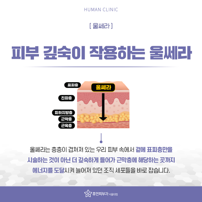 상도동피부과 처진 얼굴살 개선 방법은 무엇일까? 관련 이미지 7